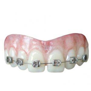 Lemmy ProFX Teeth With Braces