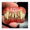 Azrael Deon Stained Teeth HSFX