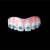 Blue Braces Upper Black HSFX