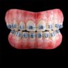 Braces Blue Black HSFX