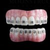 Silver Braces Black HSFX