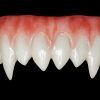 Korrigan Upper Teeth HSFX