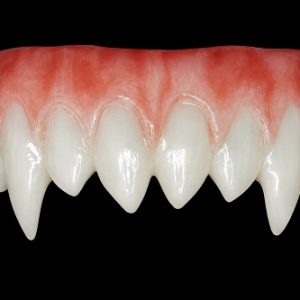 Korrigan Upper Teeth HSFX